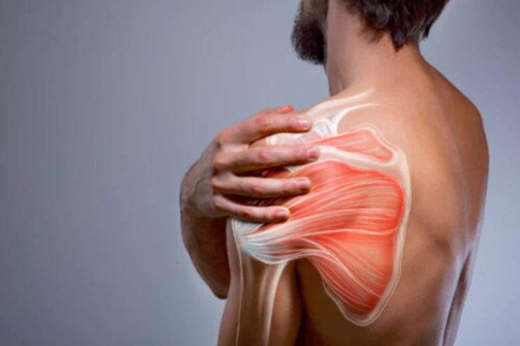 Rotator cuff injuries